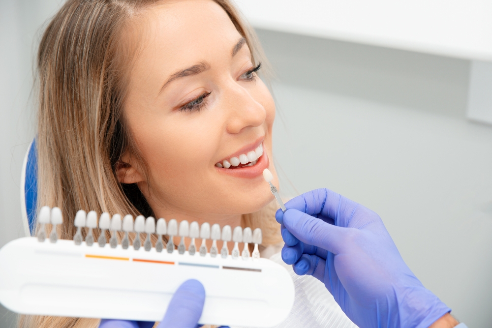 Your Perfect Smile Awaits: Everything You Need to Know About Dental Veneers in Campbellfield