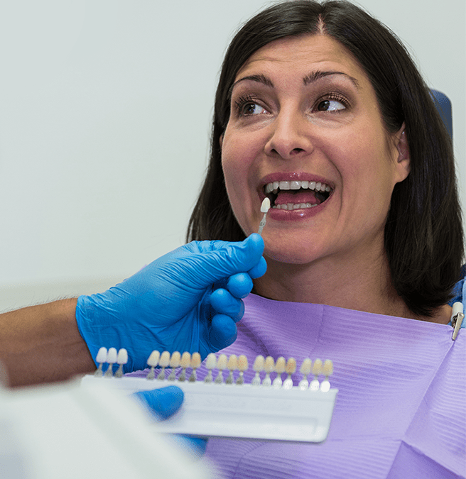 Porcelain Veneers