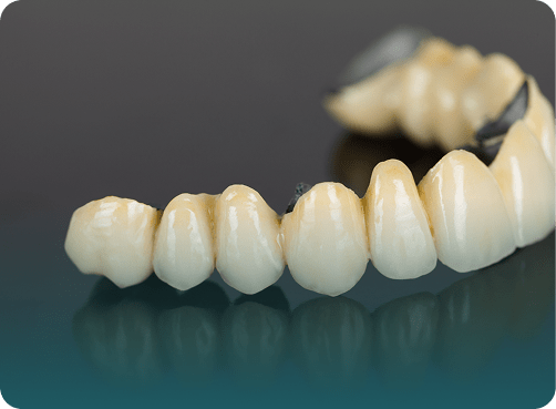 Dental Crowns