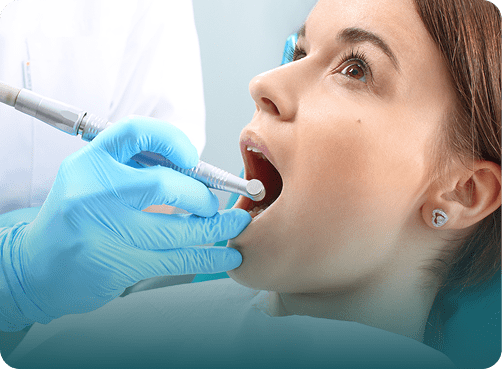 Root Canal Treatment