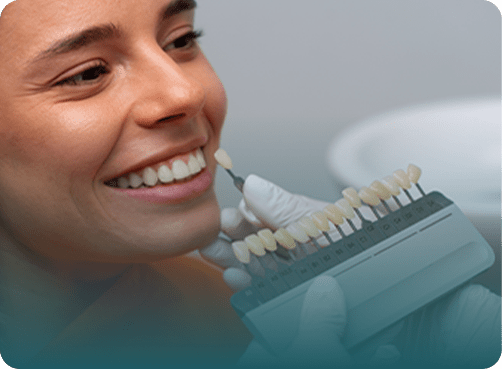 DENTAL VENEERS